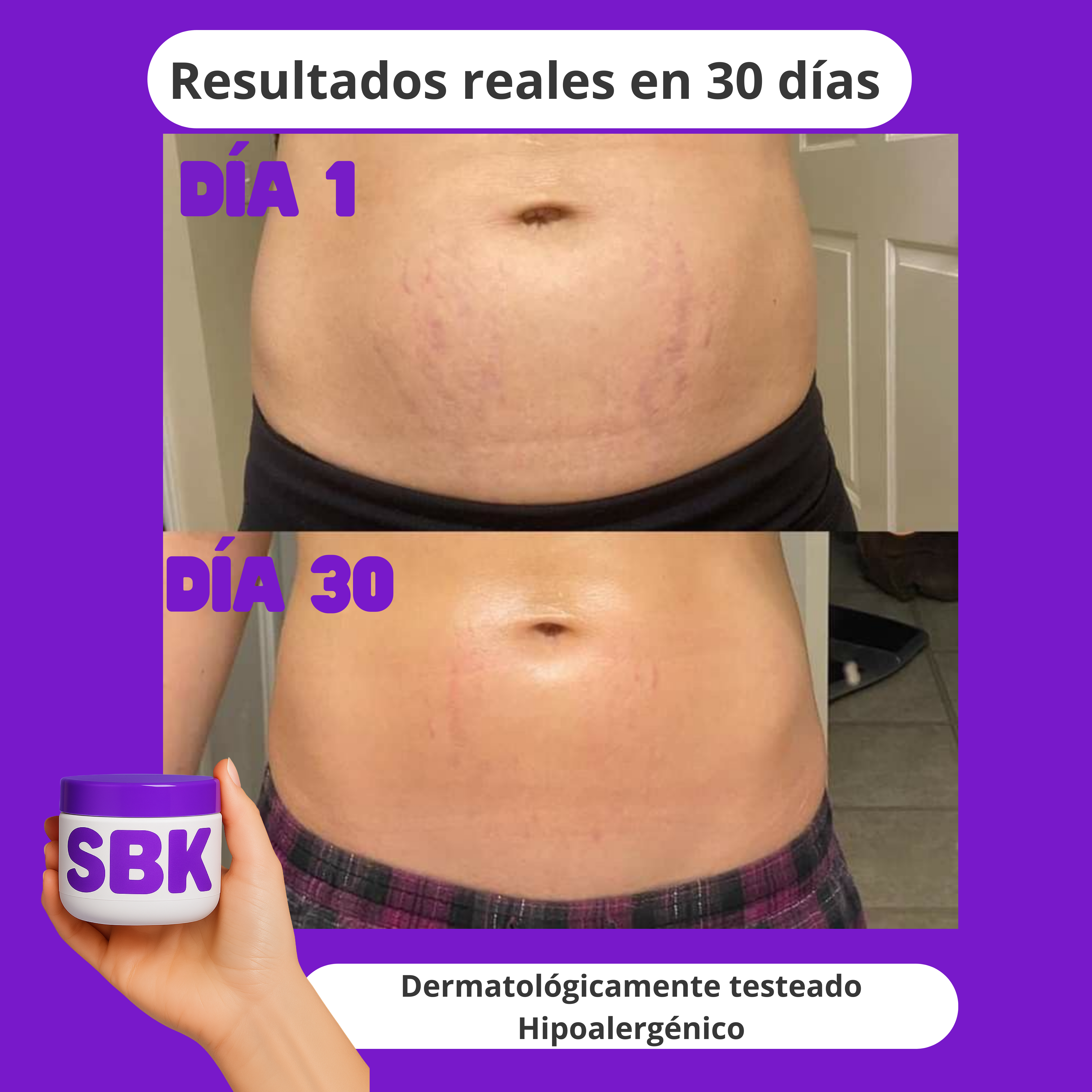 Crema Anti-Estrías Reafirmante SBK 200ml ✨ 🧴 Con Rosa Mosqueta, Centella Asiática y Ácido Hialurónico