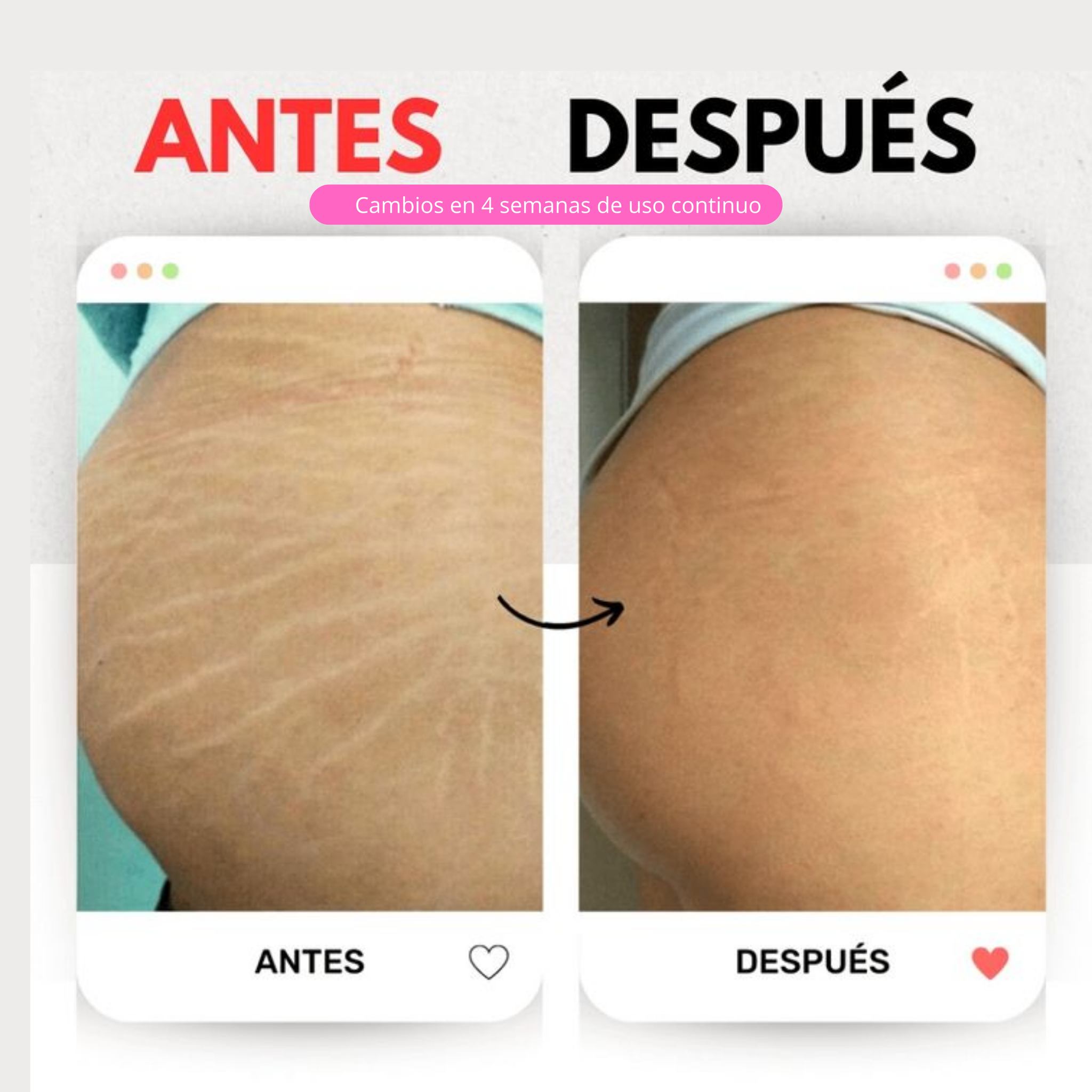 Crema Anti-Estrías Reafirmante SBK 200ml ✨ 🧴 Con Rosa Mosqueta, Centella Asiática y Ácido Hialurónico