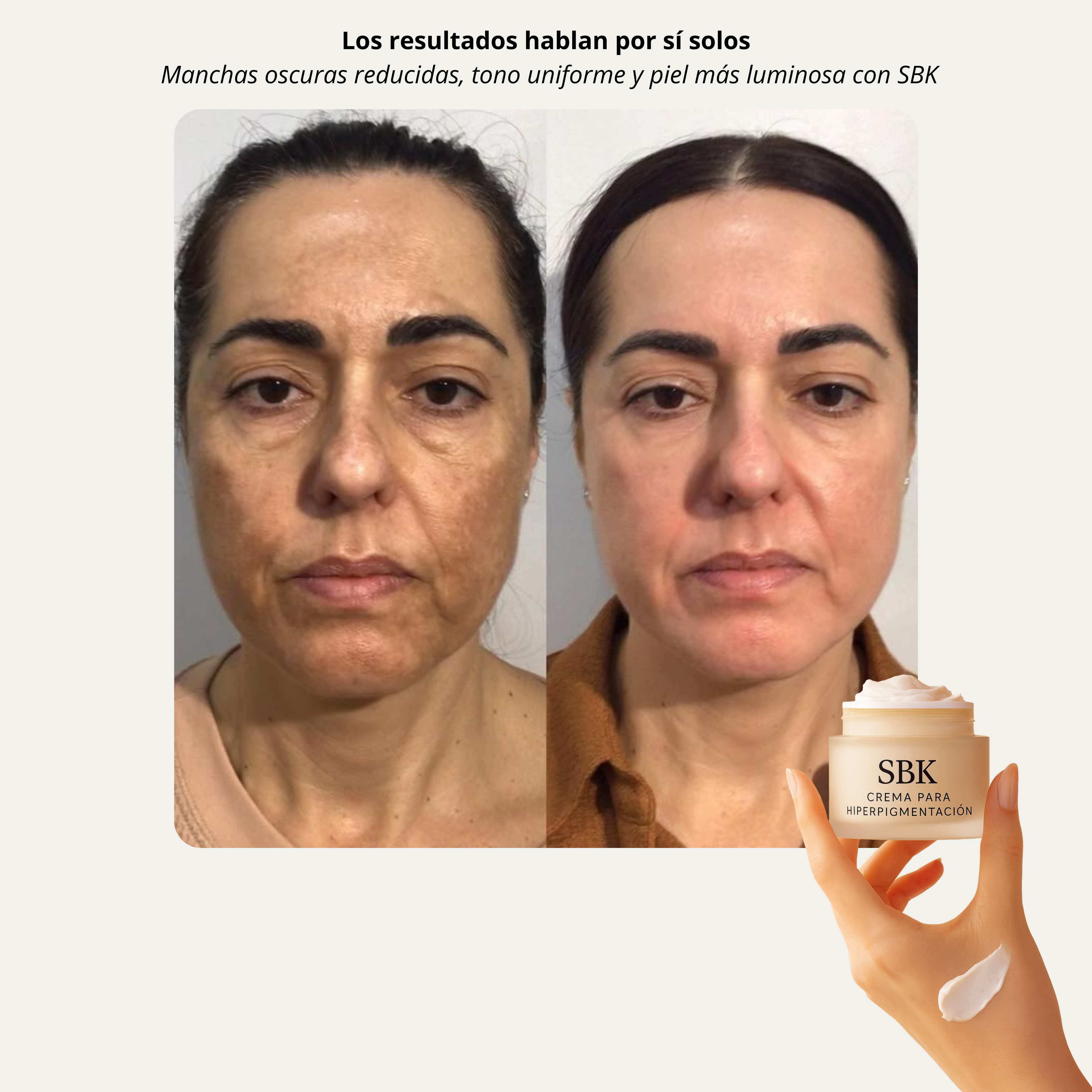 SBK Crema Despigmentante 🌸 elimina manchas y unifica el tono