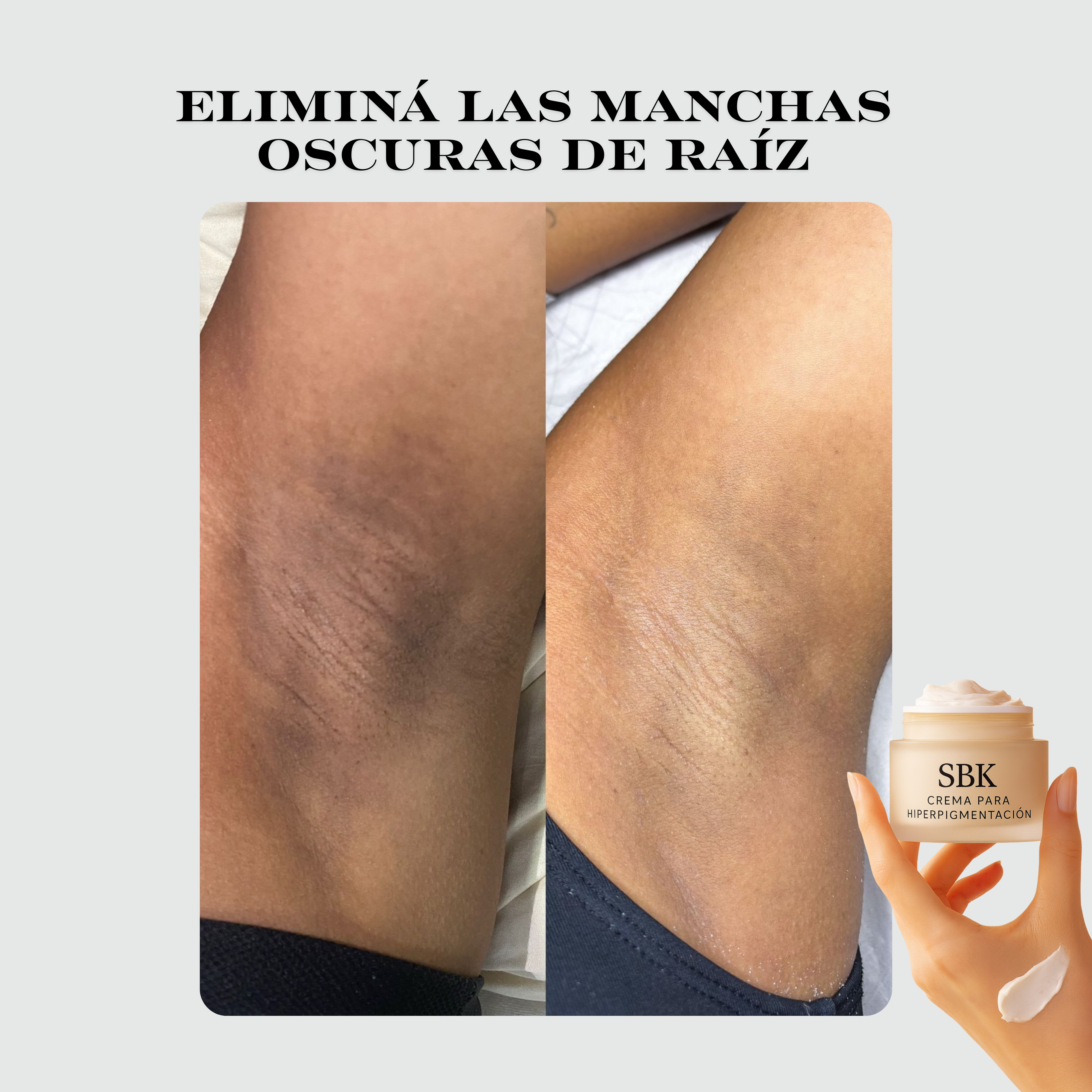 SBK Crema Despigmentante 🌸 elimina manchas y unifica el tono